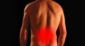ACL怪我を防ぐための効果的な予防マニュアルは？