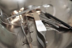 ACL手術後のケア方法にはどんなポイントがある？